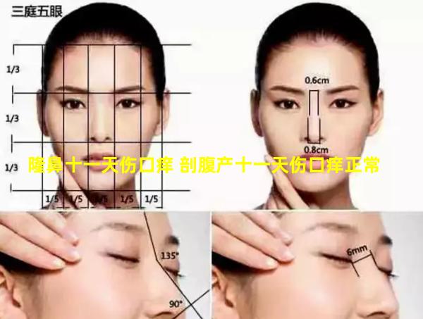 隆鼻十一天伤口痒 剖腹产十一天伤口痒正常